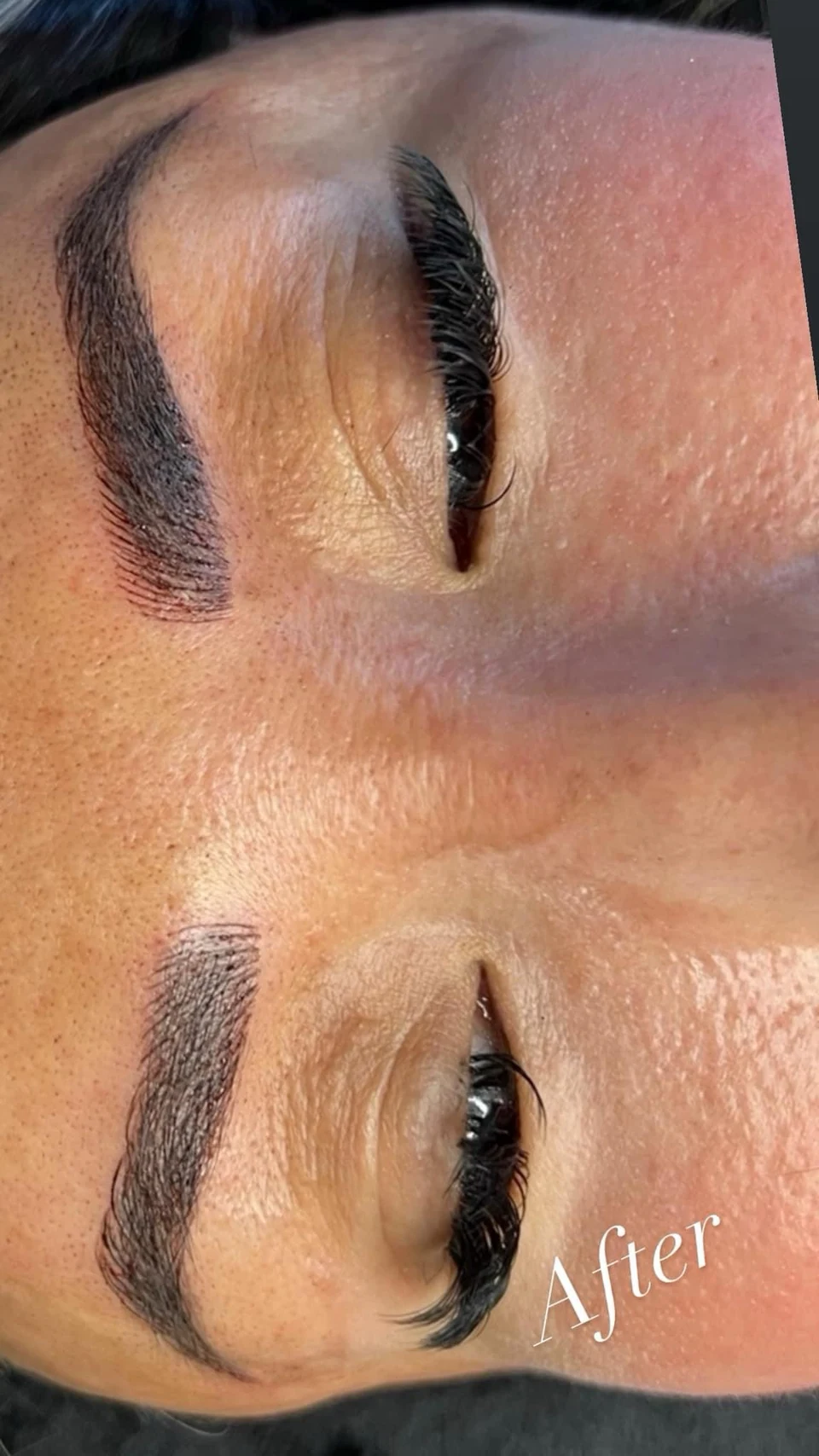 Close-up of both brows with an After label in the supplied photograph.